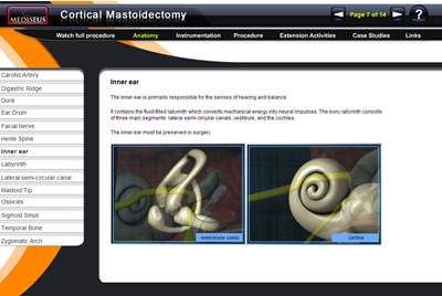 Temporal Bone 