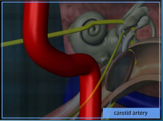 carotid artery